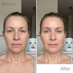 OMNIGLOW™ Contour LED Therapy Mask