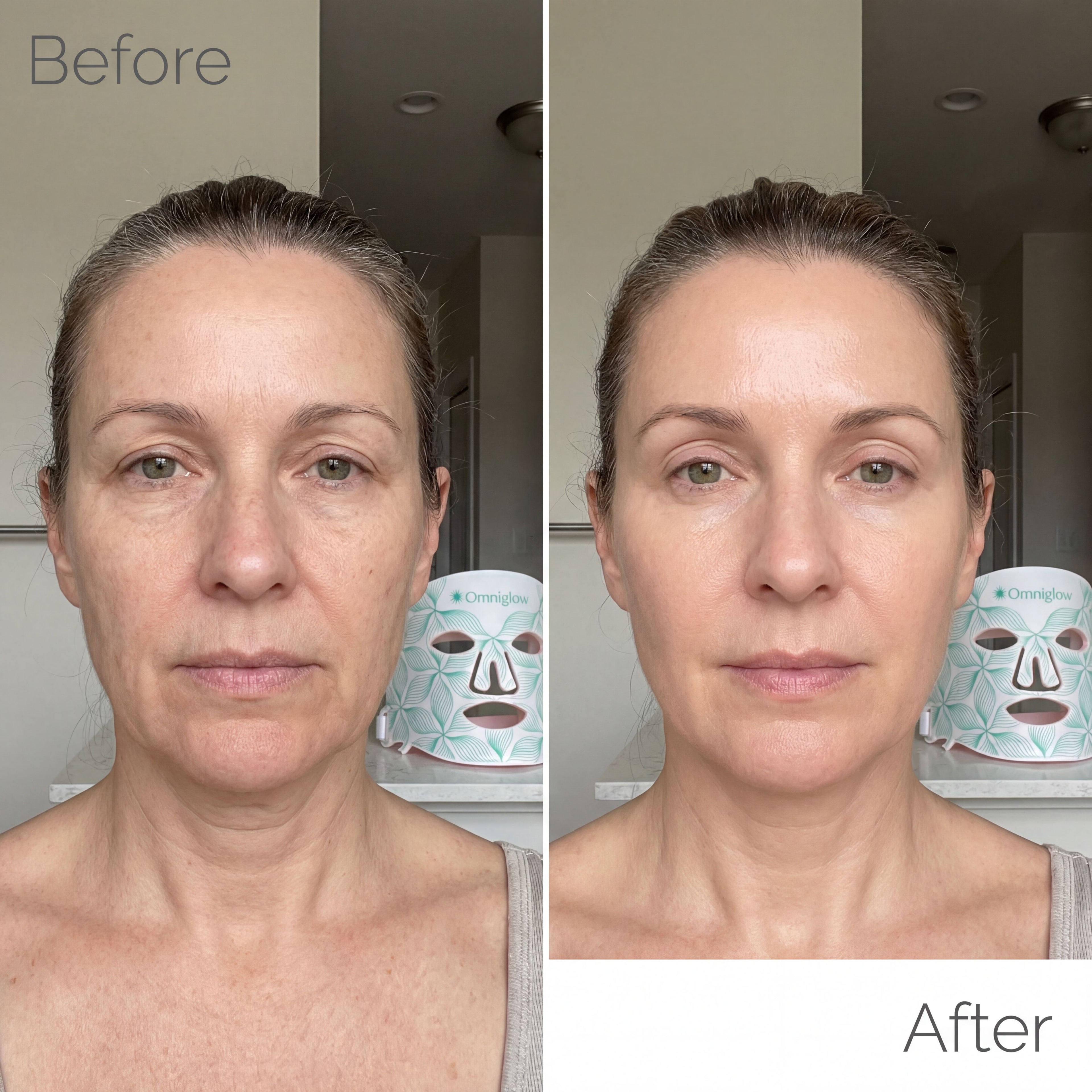 OMNIGLOW™ Contour LED Therapy Mask