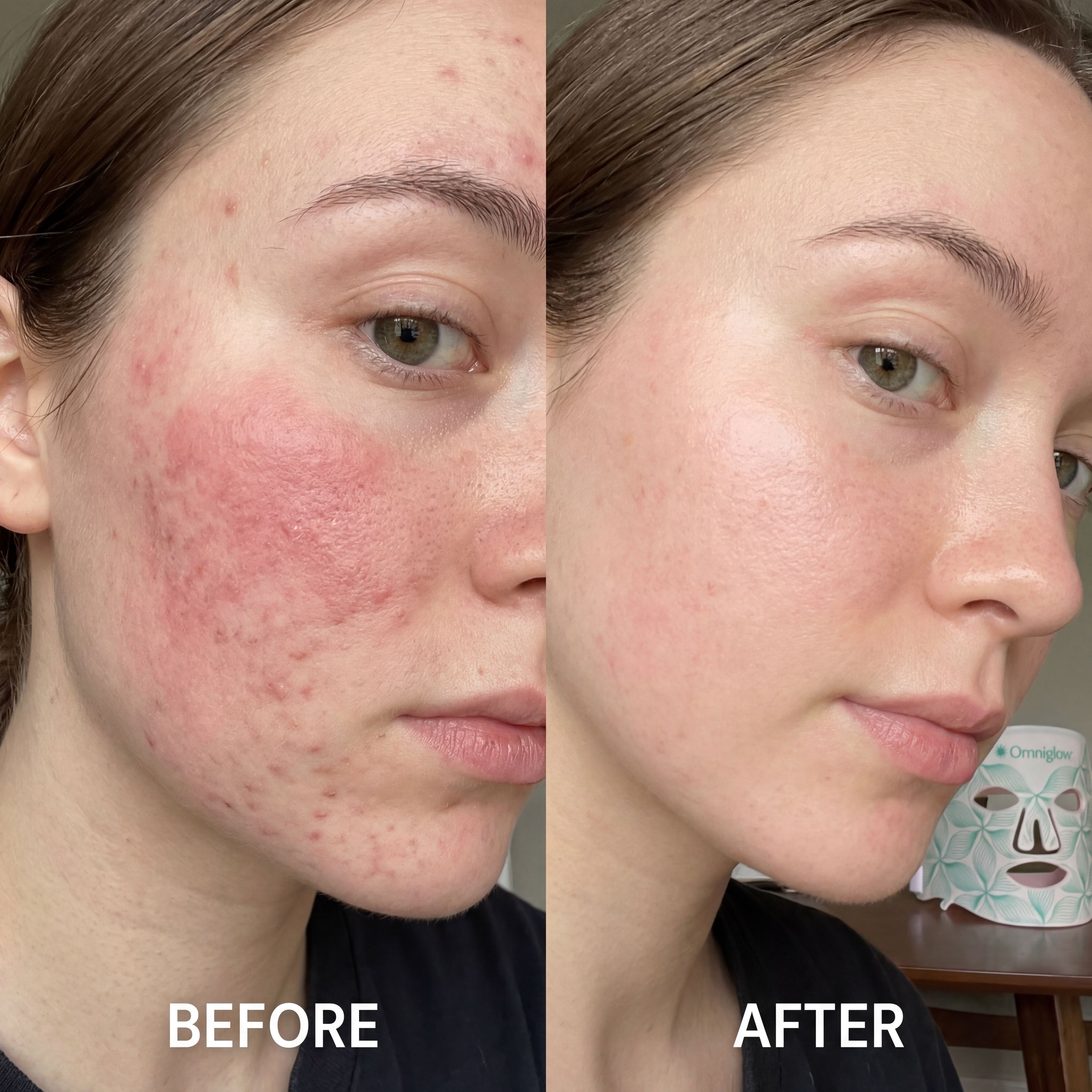 OMNIGLOW™ Contour LED Therapy Mask